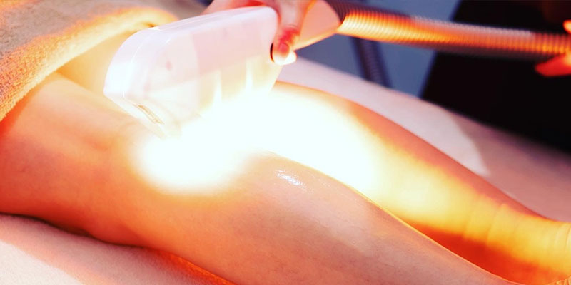 光脱毛・光フォトフェイシャル